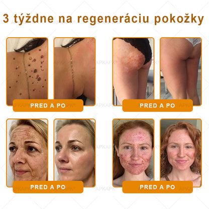 ✨APKAPK® Včelí jed regeneračný krém na pokožku 🔥 Vyvinuté na Slovensku, vyrobené a dodávané zo Slovenska