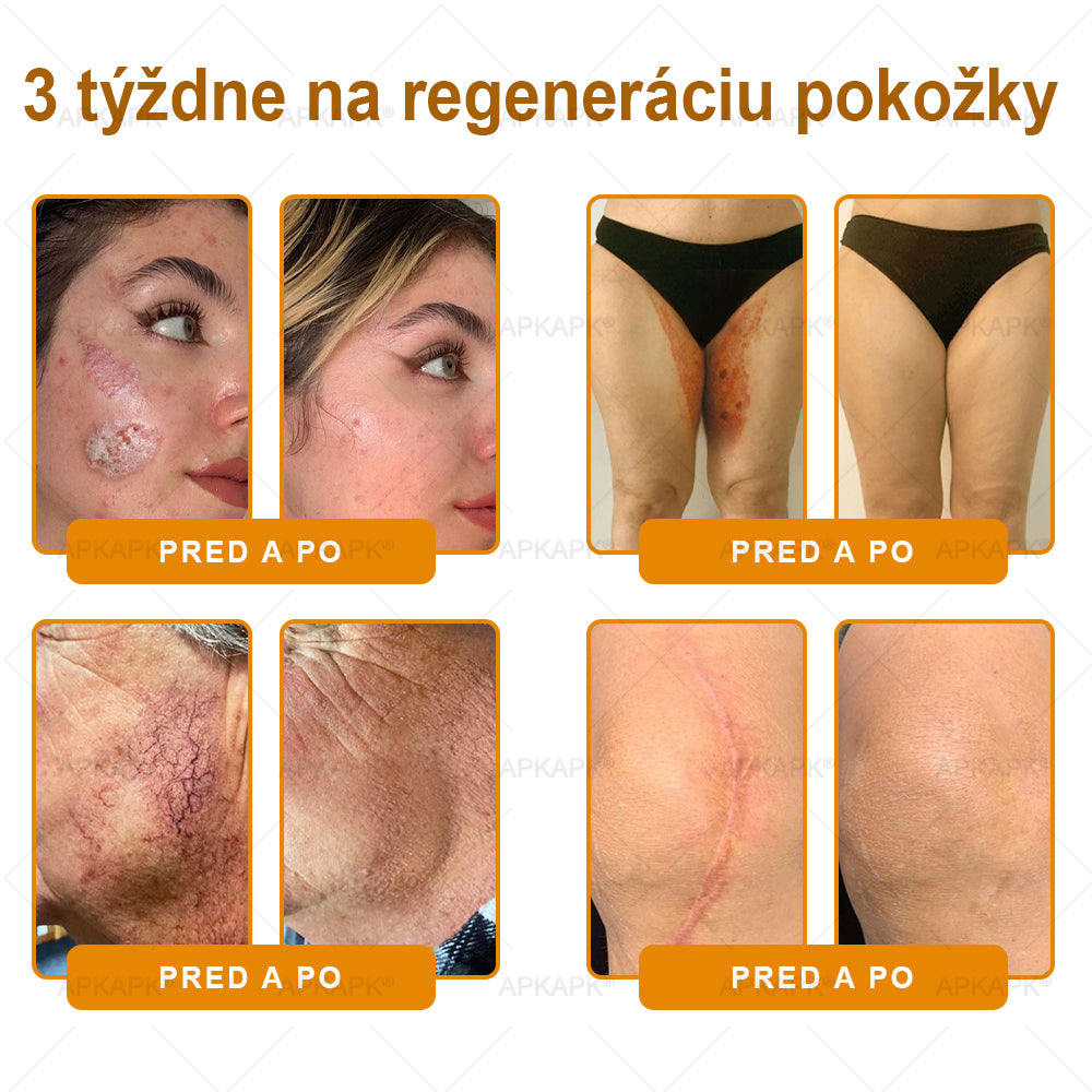 ✨APKAPK® Včelí jed regeneračný krém na pokožku 🔥 Vyvinuté na Slovensku, vyrobené a dodávané zo Slovenska