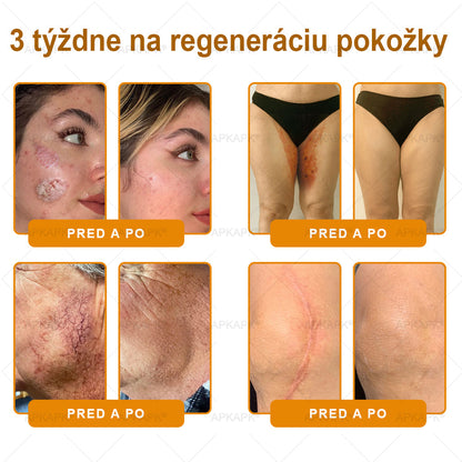 ✨APKAPK® Včelí jed regeneračný krém na pokožku 🔥 Vyvinuté na Slovensku, vyrobené a dodávané zo Slovenska