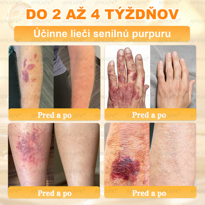 ✨APKAPK® Včelí jed regeneračný krém na pokožku 🔥 Vyvinuté na Slovensku, vyrobené a dodávané zo Slovenska