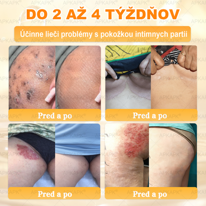✨APKAPK® Včelí jed regeneračný krém na pokožku 🔥 Vyvinuté na Slovensku, vyrobené a dodávané zo Slovenska