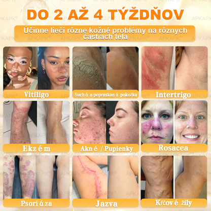 ✨APKAPK® Včelí jed regeneračný krém na pokožku 🔥 Vyvinuté na Slovensku, vyrobené a dodávané zo Slovenska