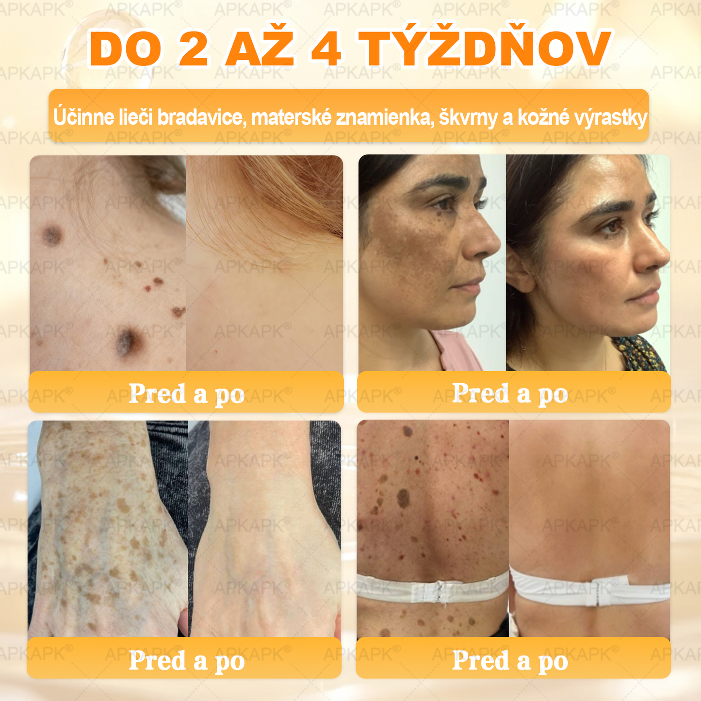 ✨APKAPK® Včelí jed regeneračný krém na pokožku 🔥 Vyvinuté na Slovensku, vyrobené a dodávané zo Slovenska