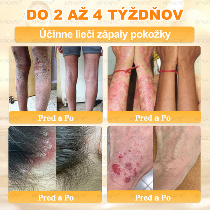 ✨APKAPK® Včelí jed regeneračný krém na pokožku 🔥 Vyvinuté na Slovensku, vyrobené a dodávané zo Slovenska